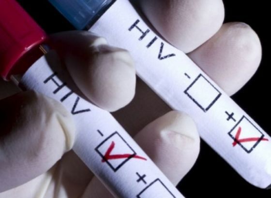 Osmanović: BiH zadržala najnižu stopu obolijevanja od HIV-a u regionu