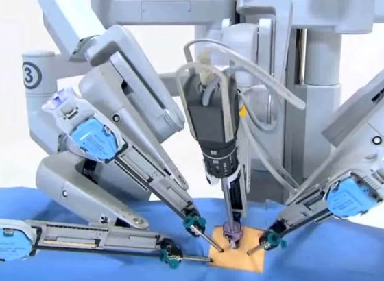 Hrvatska razvija uspješan robotizirani sustav za neurokirurgiju