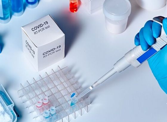Odakle potiče test za COVID-19 i koje zemlje prednjače u testiranju