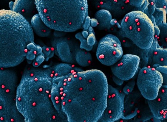 Virus mutirao, izoliran novi soj u Lombardiji