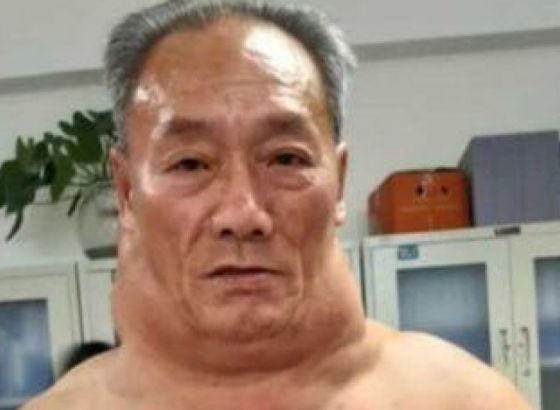 Tužna priča iza Hulk izgleda: Tan je svaki dan pio litru alkohola