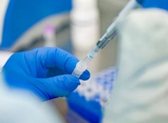 Za PCR testove nema rebalansa budžeta, nema suštinskog rada van zdravstvenih ustanova