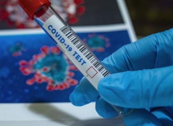 Čolpa: Srbija stavlja bijele trake na ruke građana FBiH