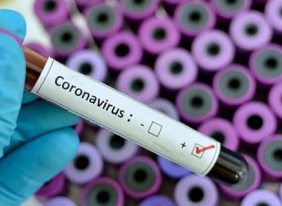 Slovenija popušta neke mjere na granici, 135 zaraženih, 38 posto cijepljenih