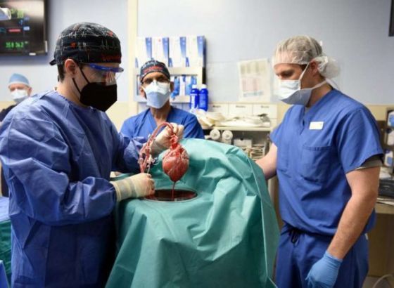 Prvi put u historiji transplantirano srce genetski modificirane svinje u čovjeka