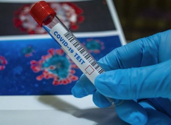 U Sloveniji od sutra za potvrdu infekcije dovoljni i brzi testovi