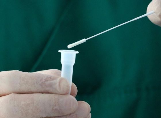 U Crnoj Gori 425 novozaraženih, preminulo devetero