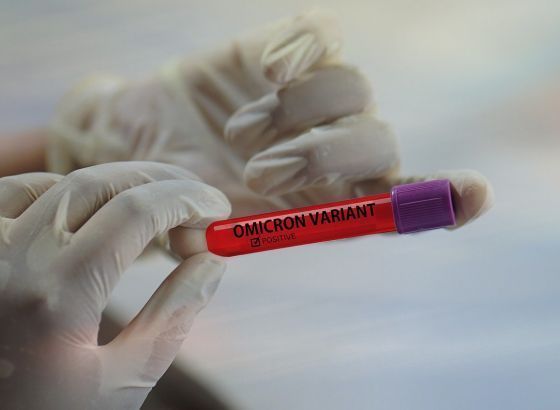 U Srbiji manje od 10.000 novozaraženih, umrlo 65 ljudi