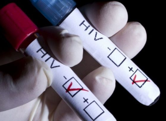 Prva žena izliječena od HIV-a nakon transplantacije matičnih ćelija