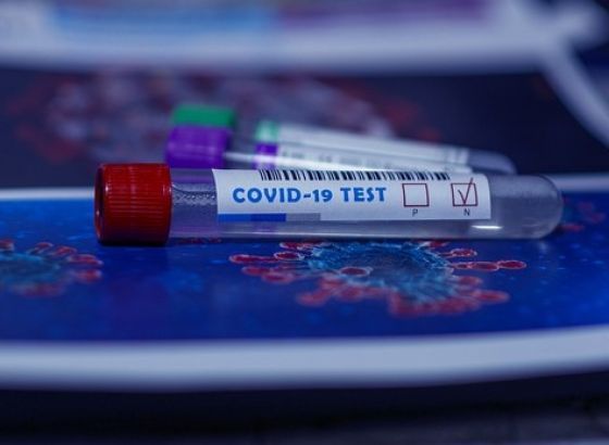 U Srbiji od koronavirusa preminule još dvije osobe, 326 novih slučajeva zaraze