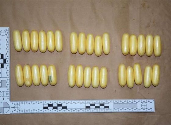 Brazilac progutao 117 kapsula ispunjenih drogom