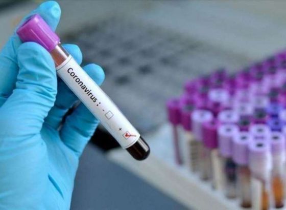 U Crnoj Gori 86 novopozitivnih, jedna osoba preminula