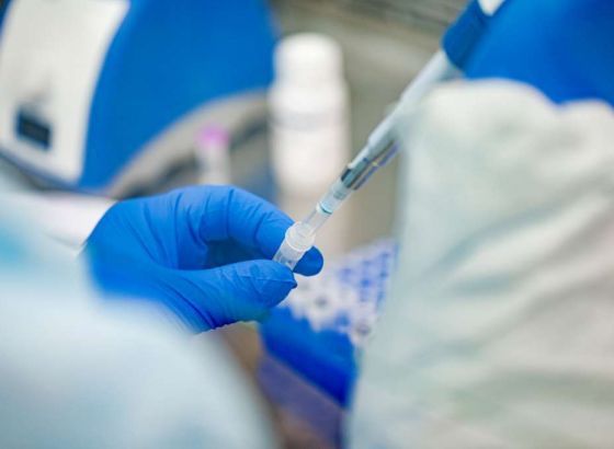 U Crnoj Gori 76 novih slučajeva koronavirusa