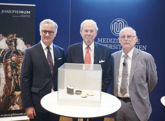 Navodni dijelovi lobanje Ludwiga van Beethovena donirani Medicinskom univerzitetu u Beču