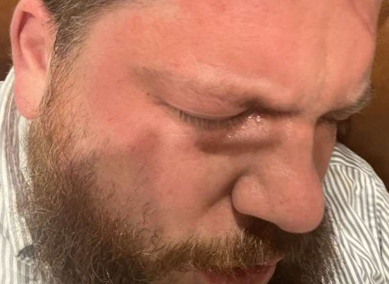 Bivši pomoćnik Navaljnog napadnut čekićem u Viljnusu