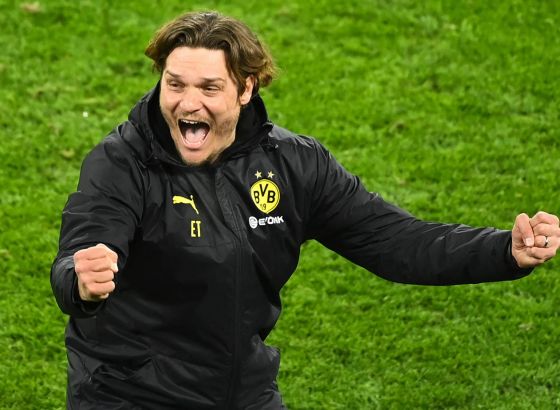 Terzić: Dva puta smo igrali protiv PSG-a ove sezone, ali sada smo mnogo bolji tim