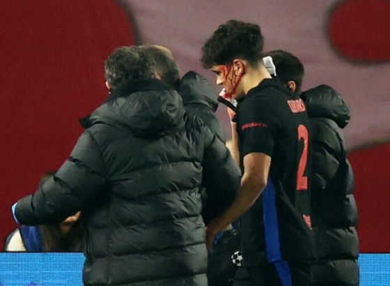 10 šavova: Evo šta je Spajić napravio Kubarsiju