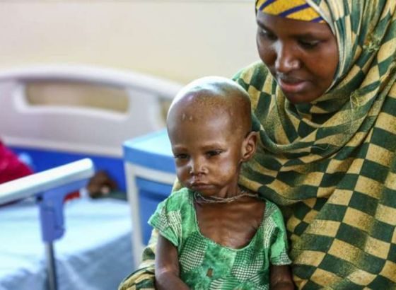 Gotovo 6,5 miliona Somalijaca suočava se s visokim nivoom gladi