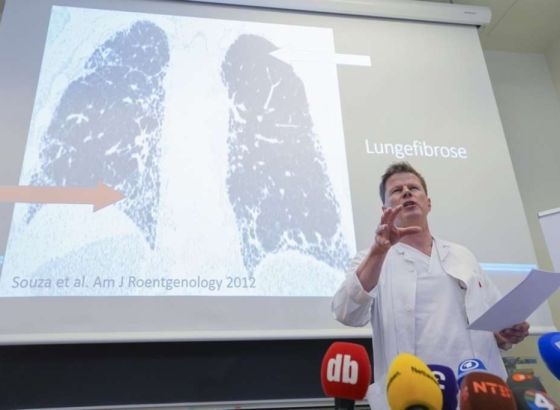 Norveška krunska princeza Mette-Marit uspješno je transplantirala pluća
